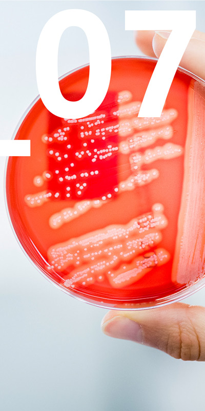 Petri dish with microorganisms