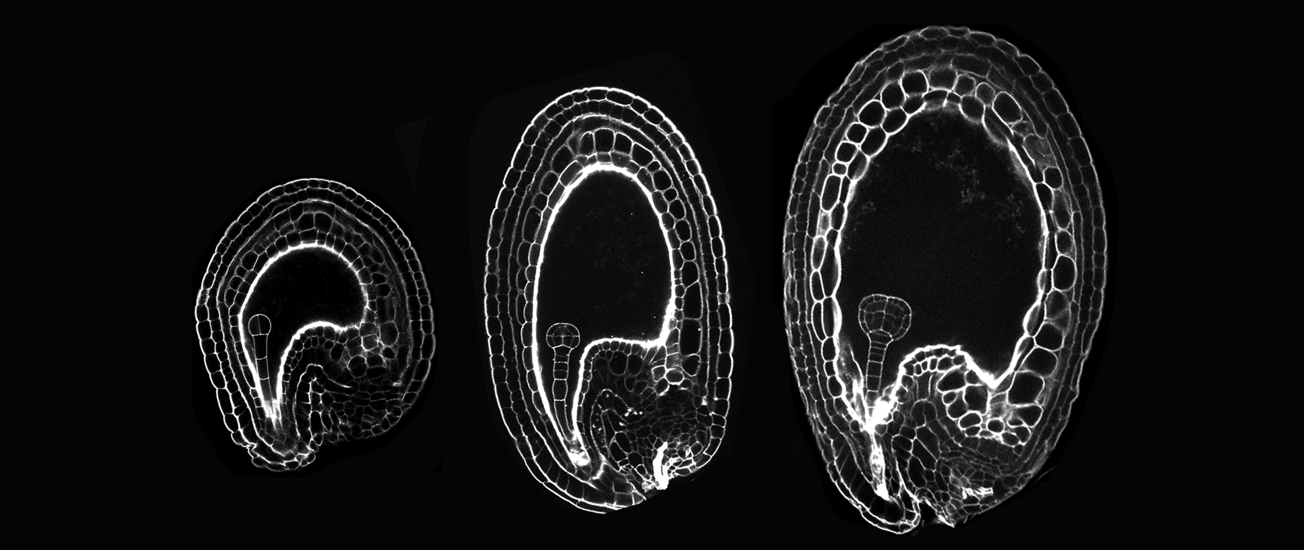 Arabidopsis' embryos