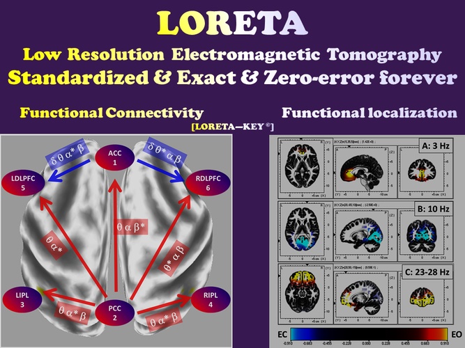 loreta logo